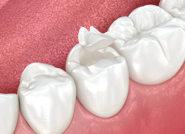 Best Dentures (Full and Partial)  in Maryland Heights, MO